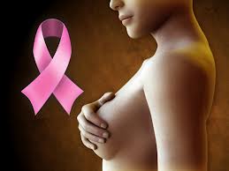 cáncer de mama